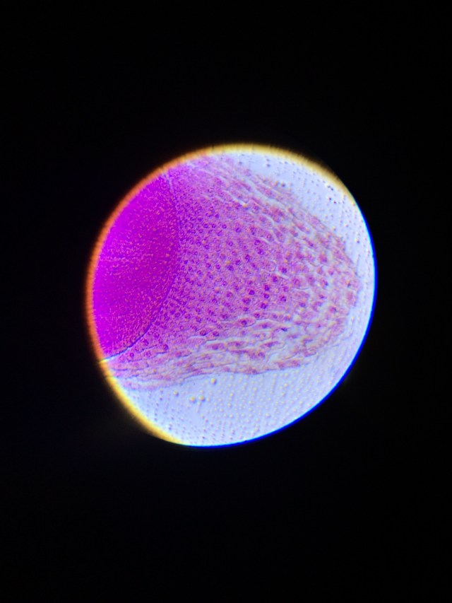 By placing the iPhone up to the microscope lens, you could clearly see the dividing cells in a corn root