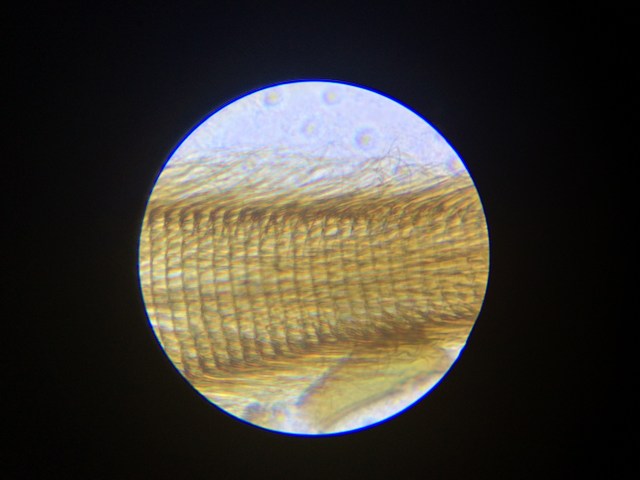 At high magnification, you can see the individual hairs